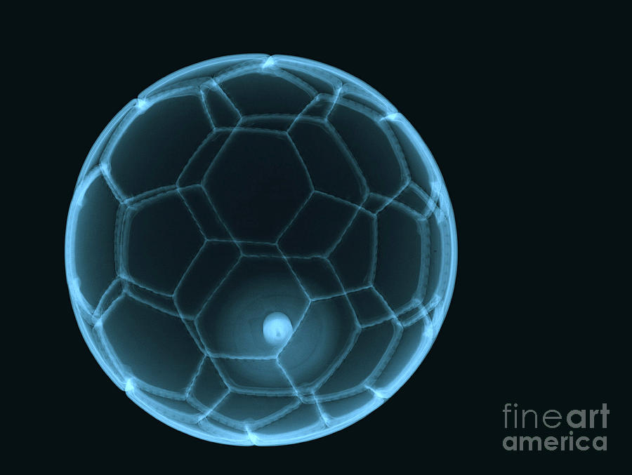 Soccer Ball X-ray Photograph by Eurelios