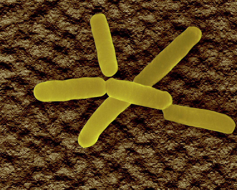 Soil Bacterium (bradyrhizobium Sp.) #1 Photograph by Dennis Kunkel Microscopy/science Photo Library