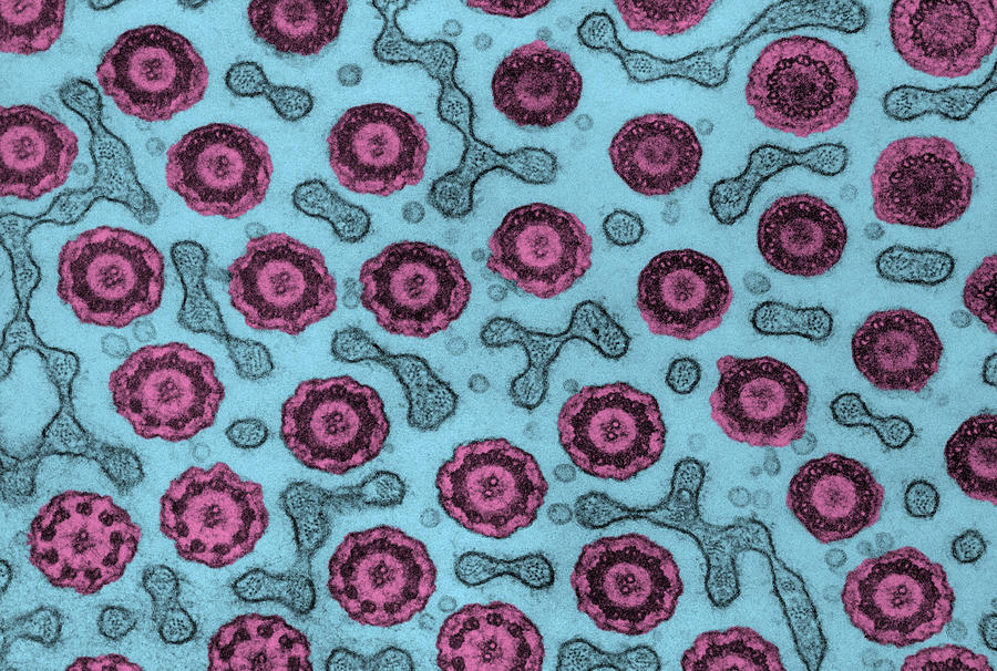 Sperm Flagella, Tem #1 Photograph by Biology Pics