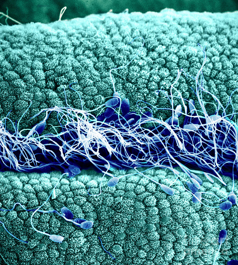 Sperm On Oviduct Surface, Sem #1 Photograph by David M. Phillips