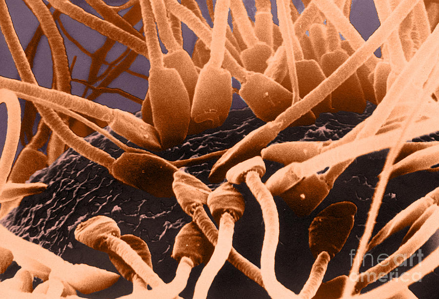 Sperm On Surface Of Egg, Sem #1 Photograph by David M. Phillips