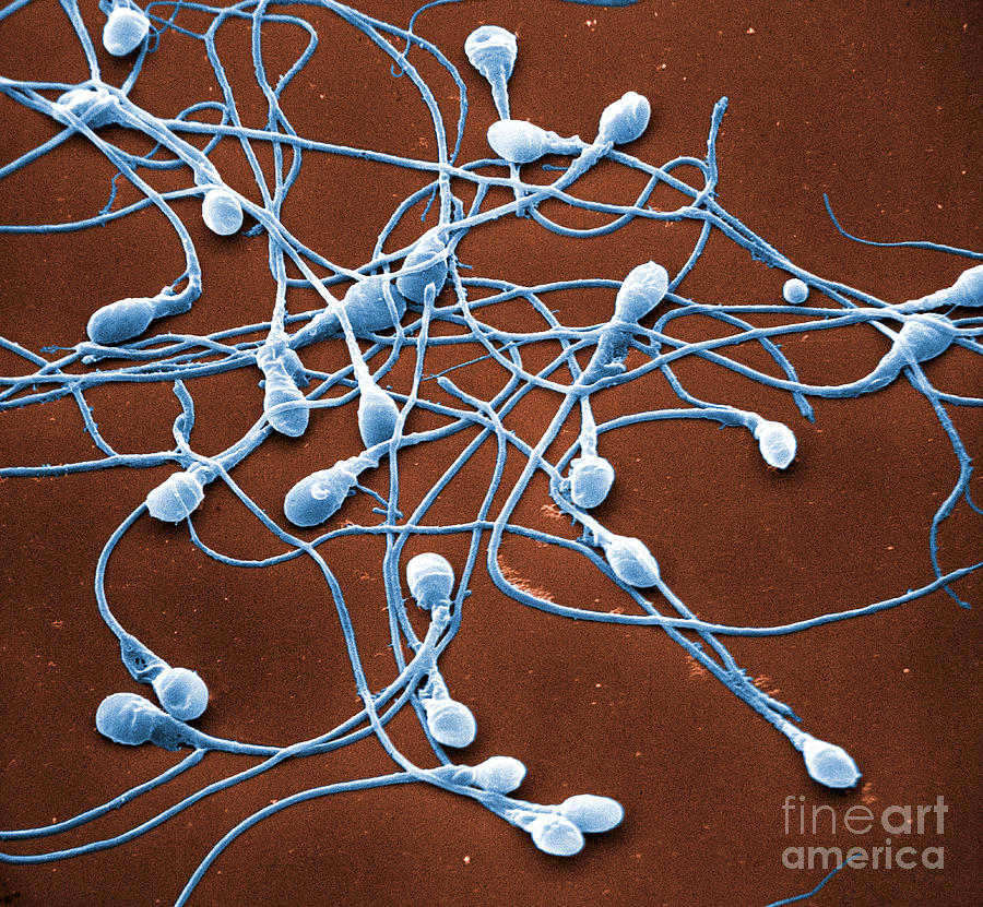 Sperm, Sem #1 Photograph by David M. Phillips