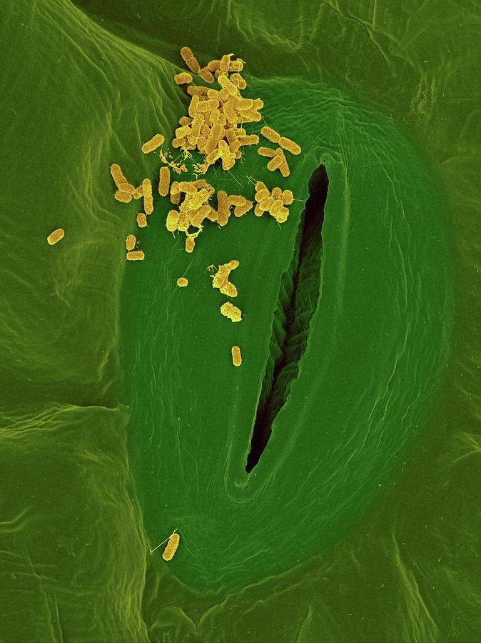 Spinach Infected With E. Coli #1 Photograph by Dennis Kunkel Microscopy/science Photo Library