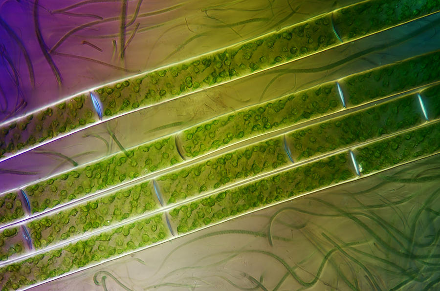 Spirogyra Sp., And Rivularia, Lm #1 Photograph by Marek Mis