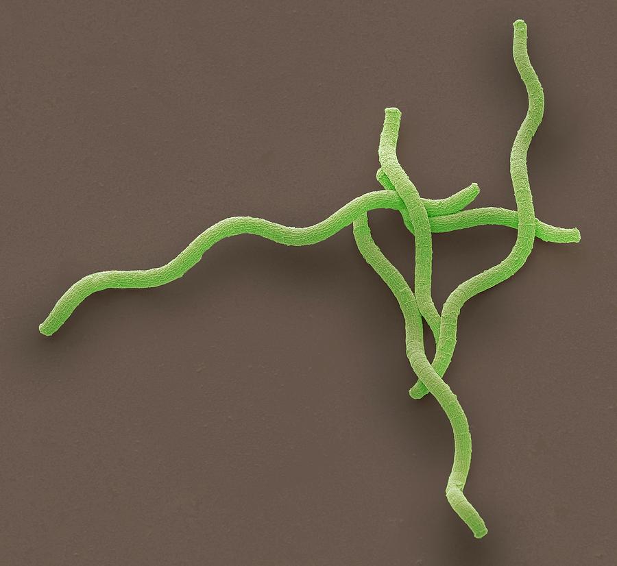 Spirulina Cyanobacteria #1 Photograph by Steve Gschmeissner
