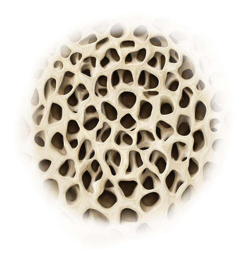 Spongy Bone Tissue, Illustration #1 Photograph by QA International
