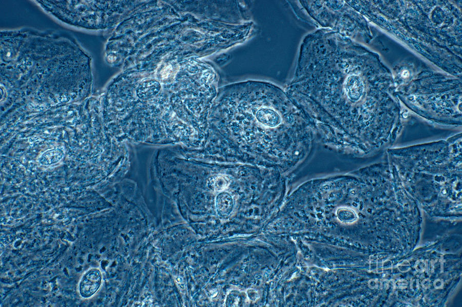 Squamous Epithelial Cells, Lm #1 Photograph by David M. Phillips