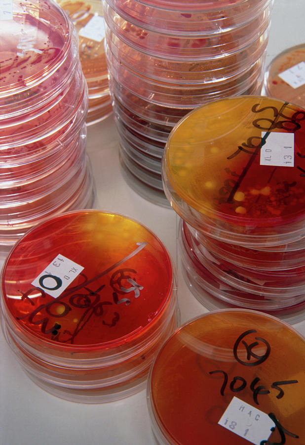 Stacks Of Petri Dish Faecal Bacterial Cultures #1 Photograph by Jim Varney/science Photo Library