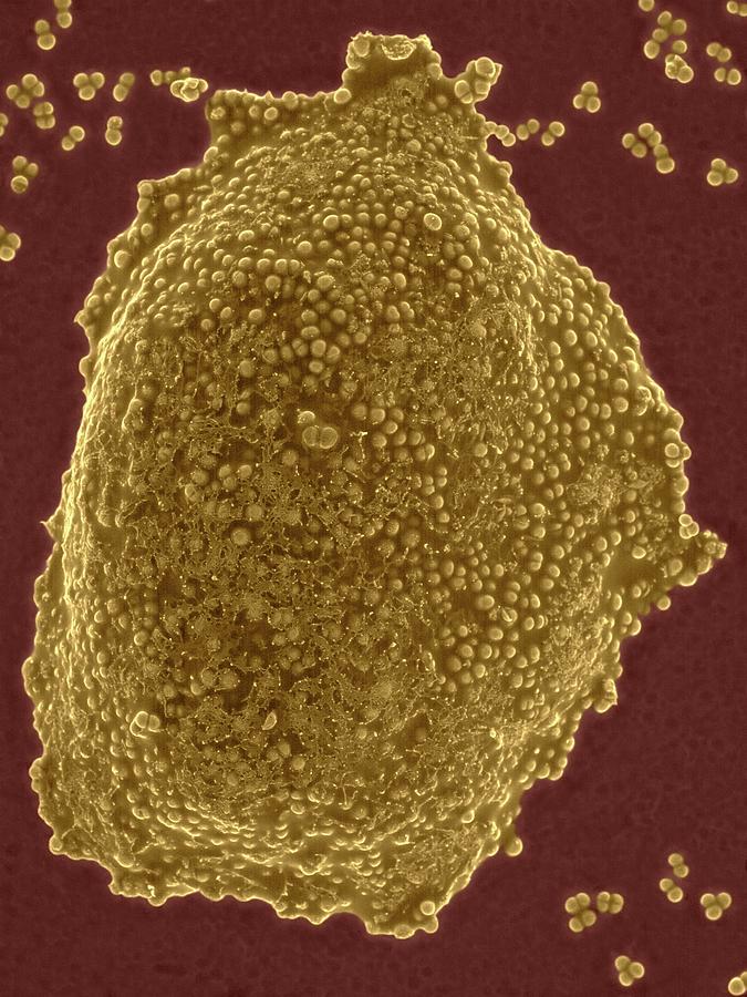 Staphylococcus Aureus Colony Mrsa Strain Photograph By Dennis Kunkel