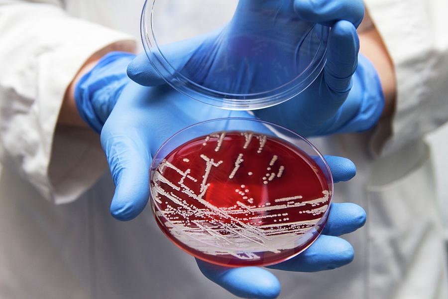 Staphylococcus Aureus Culture #1 Photograph by Daniela Beckmann / Science Photo Library