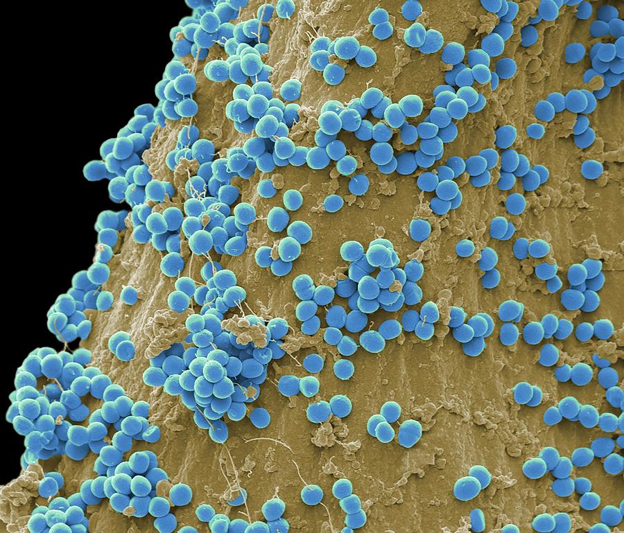 Staphylococcus Bacteria Photograph By Steve Gschmeissner Science Photo