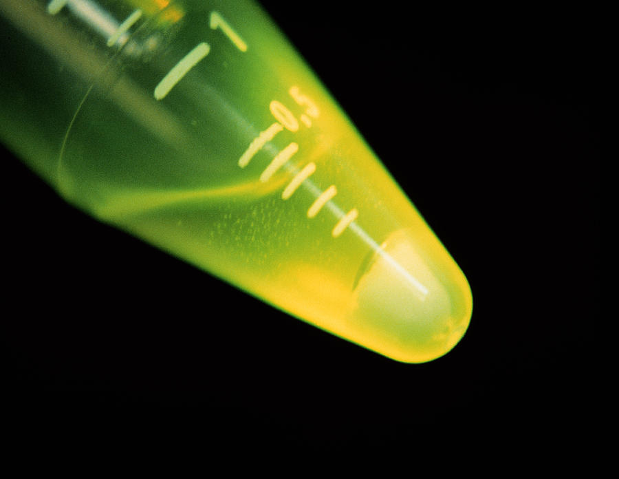 Stem Cell Culture #1 Photograph by Science Photo Library Stem Cell Culture #1 Photograph by Science Photo Library