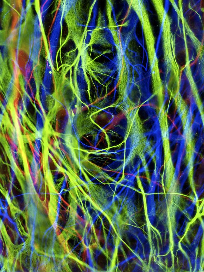 Stem cell-derived astrocyte brain cells Photograph by Science Photo ...