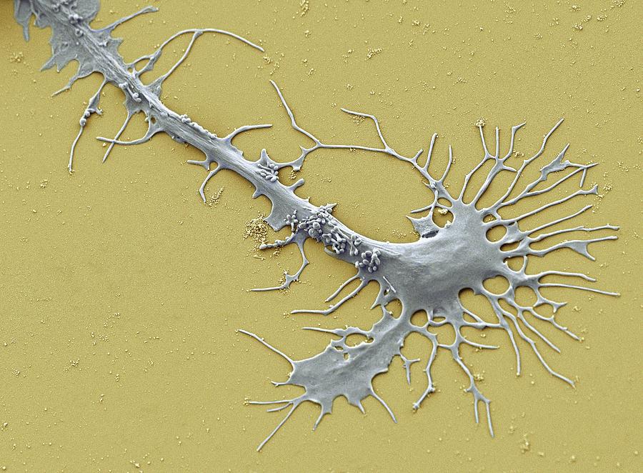 Stem Cell-derived Neuron Growth Cone #1 Photograph by Thomas Deerinck, Ncmir/science Photo Library