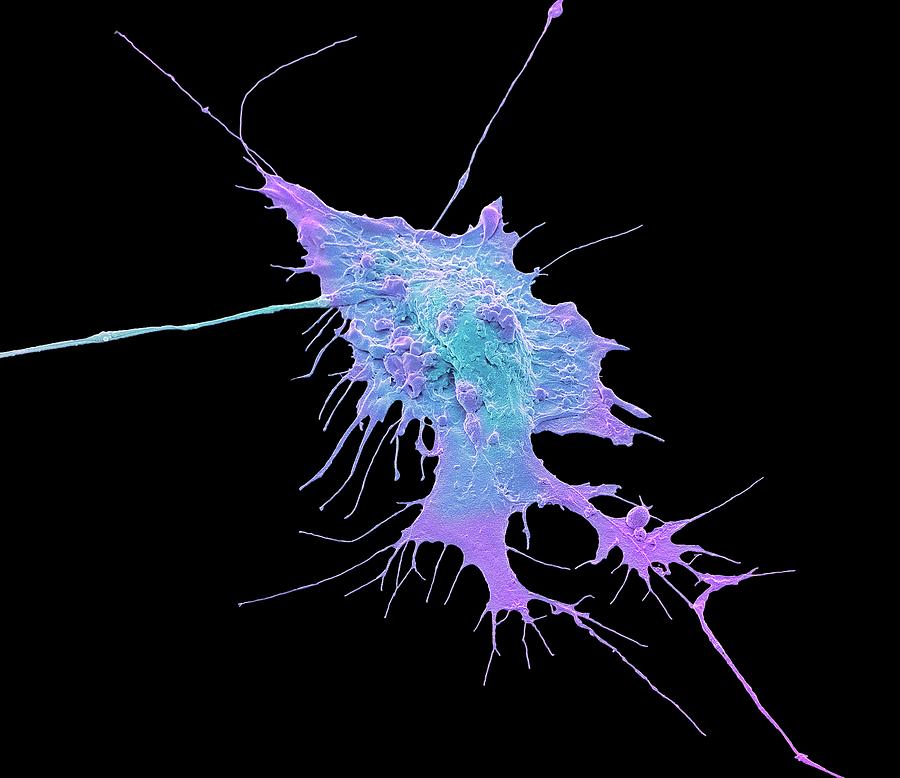 Stem Cell-derived Neuron #1 Photograph by Steve Gschmeissner