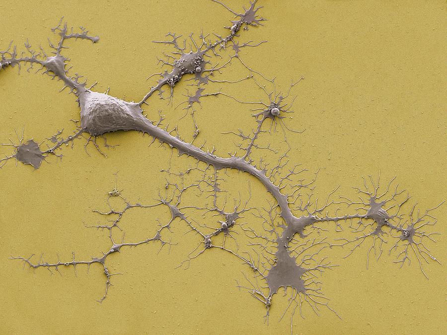 Stem Cell-derived Neuron #1 Photograph by Thomas Deerinck, Ncmir/science Photo Library