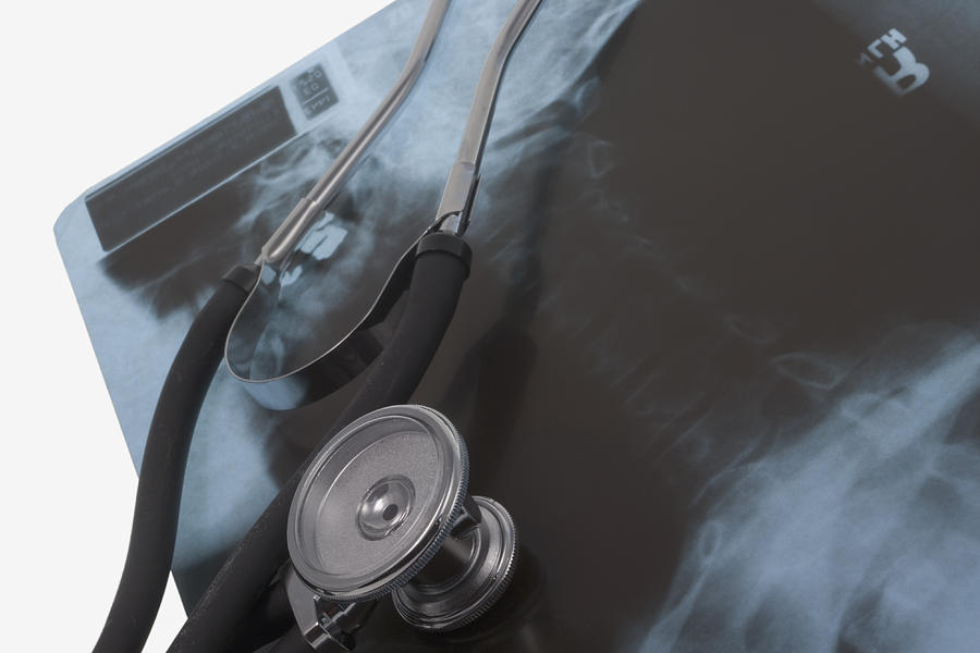 Stethoscope And X-ray #1 Photograph by Science Stock Photography