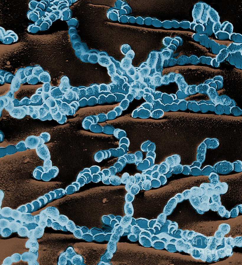 Streptococcus Bacteria, Sem #1 Photograph by David M. Phillips