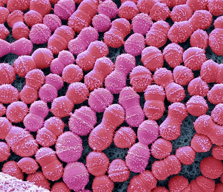 Streptococcus Mutans Photograph By Steve Gschmeissnerscience Photo