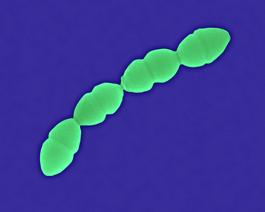 Streptococcus Pneumoniae Coccus Prokaryote 1 By Dennis Kunkel Microscopyscience Photo Library 1945