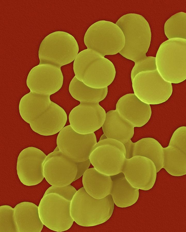 Streptococcus Viridans