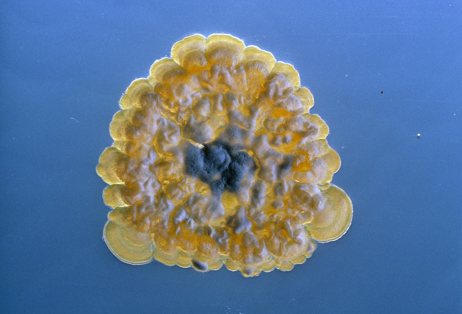 Streptomyces Colony #1 Photograph by Perennou Nuridsany