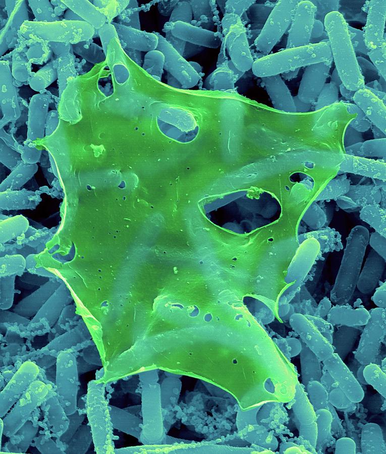 Streptomyces Hygroscopicus #1 Photograph by Dennis Kunkel Microscopy/science Photo Library