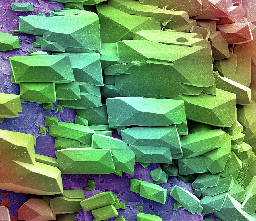 Sugar Crystals Photograph by Steve Gschmeissner