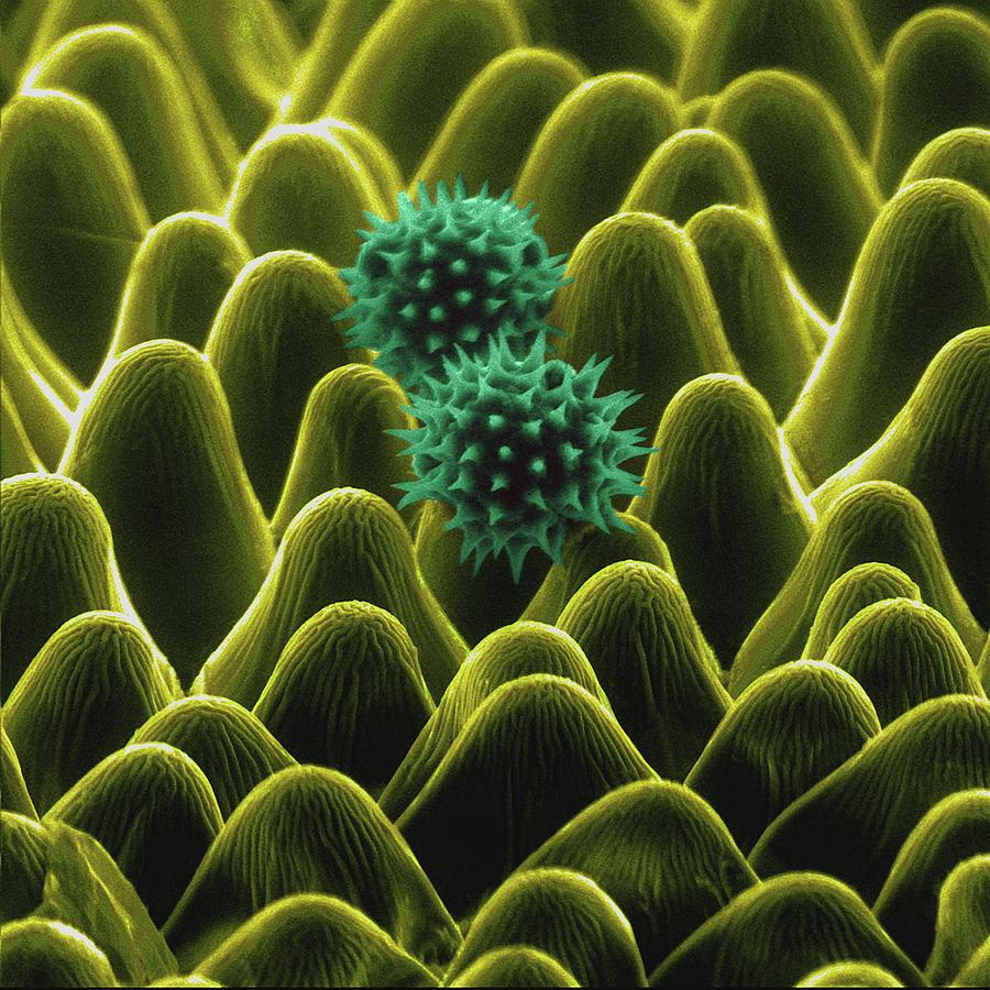 Sunflower Petal Photograph by Dennis Kunkel Microscopy/science Photo ...