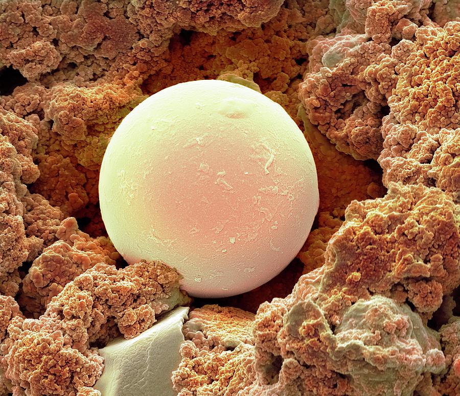 Scanning Electron Micrograph Photograph - Sunscreen Microsphere #1 by Steve Gschmeissner