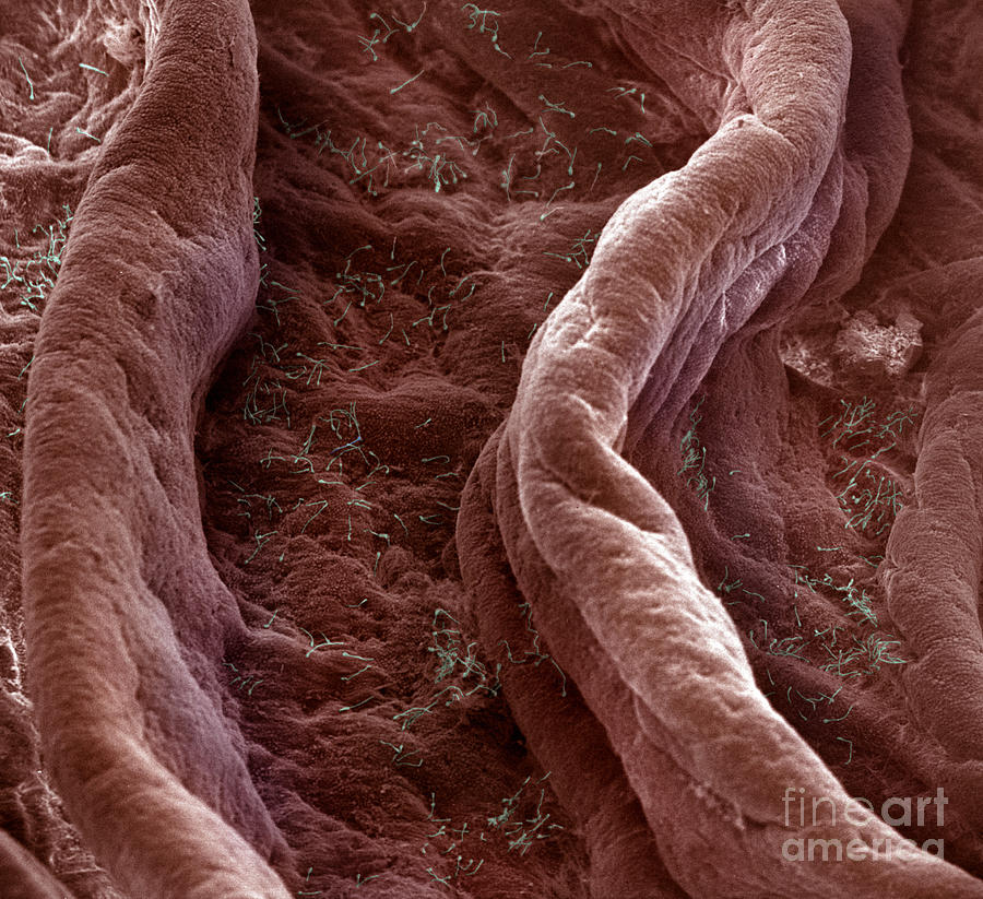 Surface Of Human Vagina #1 Photograph by David M. Phillips