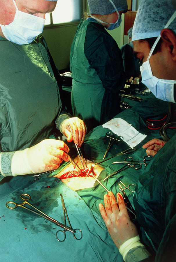 Post-operative care, tendon surgery - Stock Image - M555/0050 - Science  Photo Library