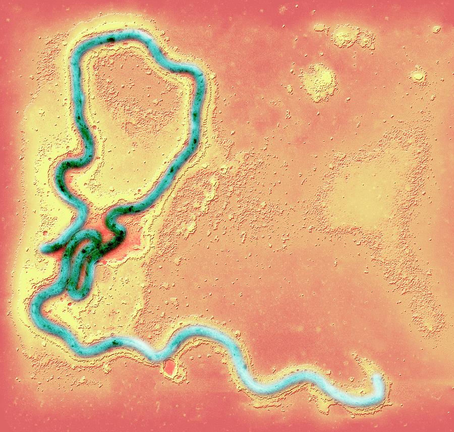 Syphilis Bacterium #1 Photograph by Ami Images/science Photo Library