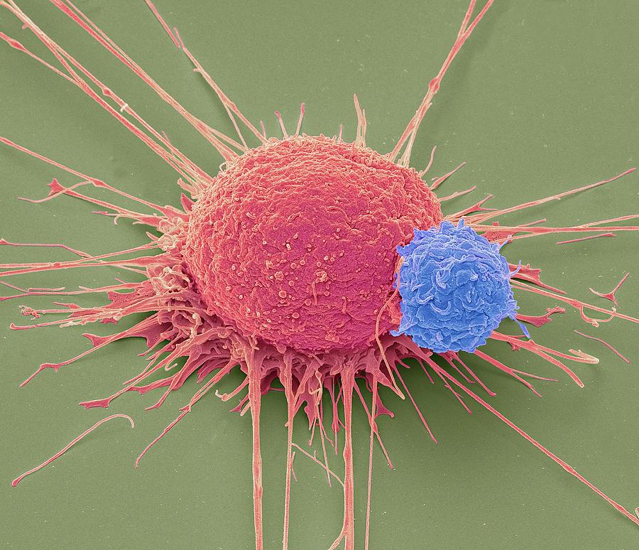 T Lymphocyte And Cancer Cell #1 Photograph by Steve Gschmeissner