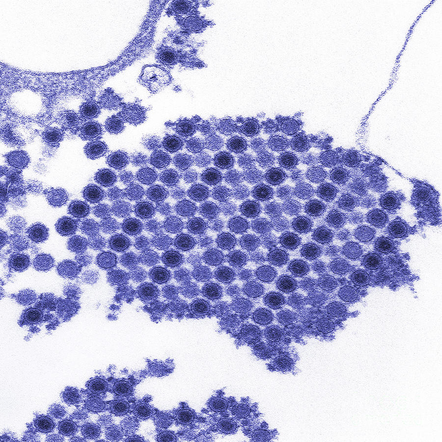 Tem Of Chikungunya Virus #1 Photograph by Science Source