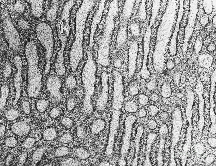 Tem Of Endoplasmic Reticulum Photograph by David M. Phillips - Fine Art ...