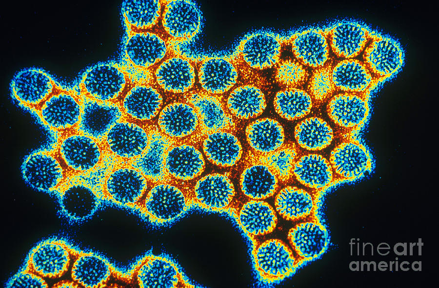 Tem Of Rotavirus #1 Photograph by Scott Camazine/CDC