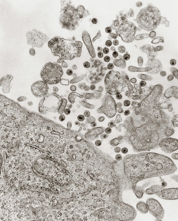 Tem Of Simian Immunodeficiency Viruses (siv) Photograph by University