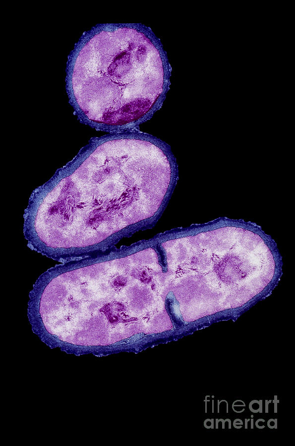 Tem Propionibacterium Acnes #1 Photograph by Kwangshin Kim
