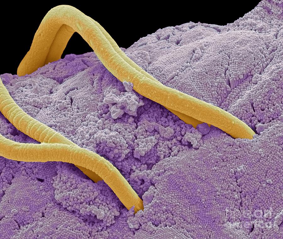 Threadworms In The Gut, Sem Photograph by David Mccarthy - Pixels