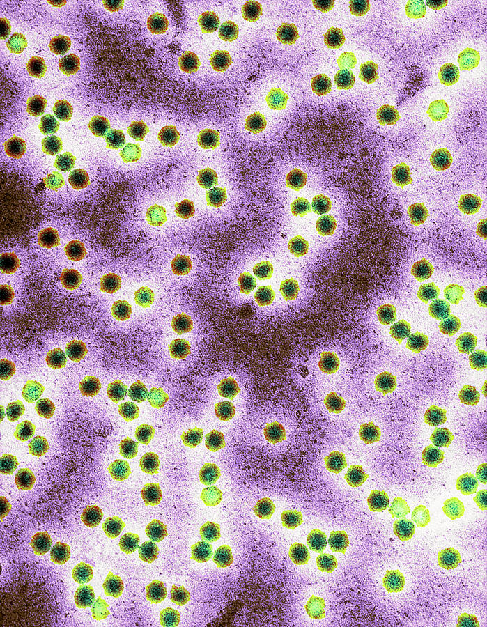Tobacco Photograph - Tobacco Necrosis Virus #1 by Centre For Bioimaging, Rothamsted Research/science Photo Library