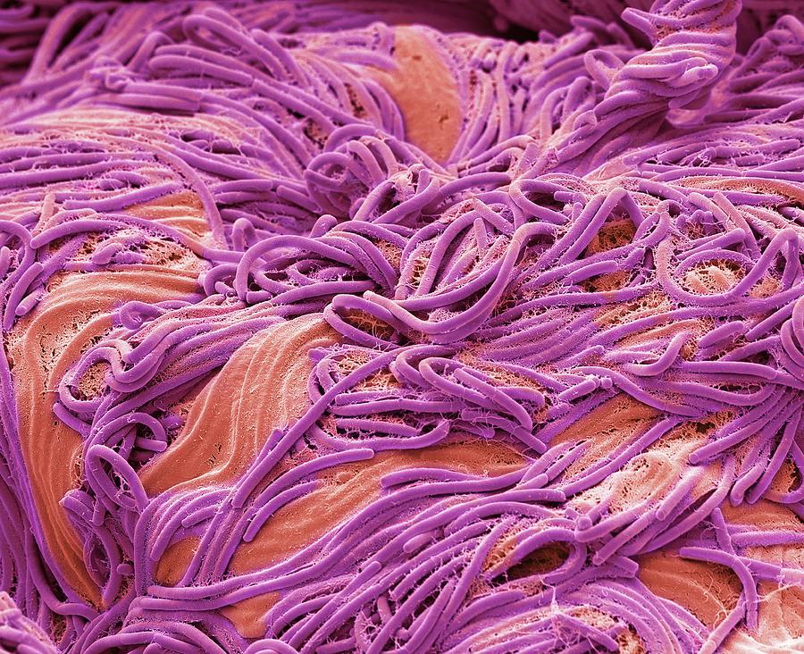 Tongue Bacteria #1 Photograph by Steve Gschmeissner/science Photo Library