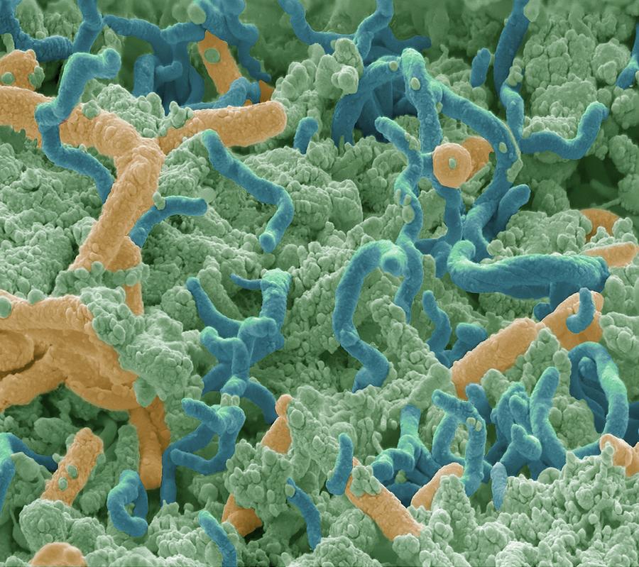 Tooth Bacteria #1 by Science Photo Library