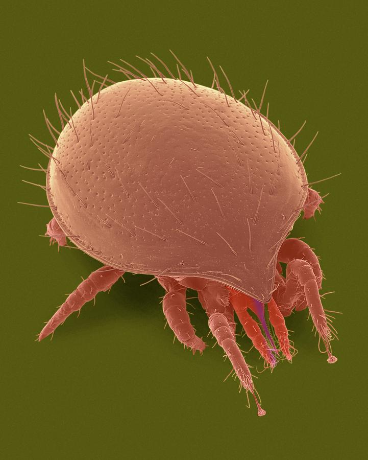 Tortoise Mite (family Uropodidae) #1 Photograph by Dennis Kunkel Microscopy/science Photo Library