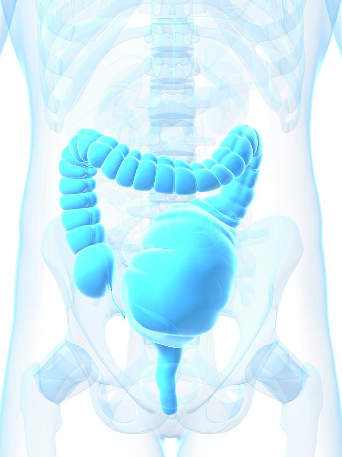 Toxic Megacolon Photograph by Sciepro/science Photo Library Fine Art