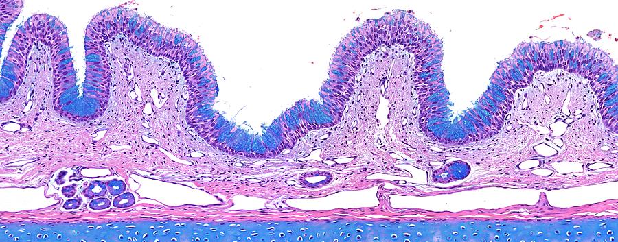 Columnar Epithelium Photograph - Trachea #1 by Microscape