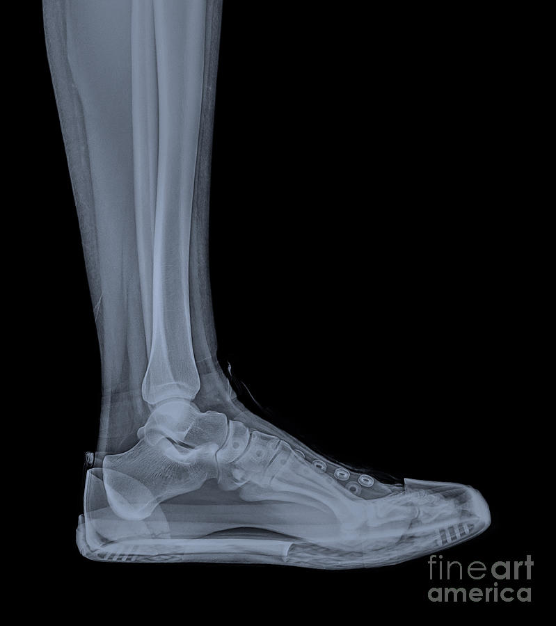 Trainers  X-Ray  #1 Photograph by Guy Viner