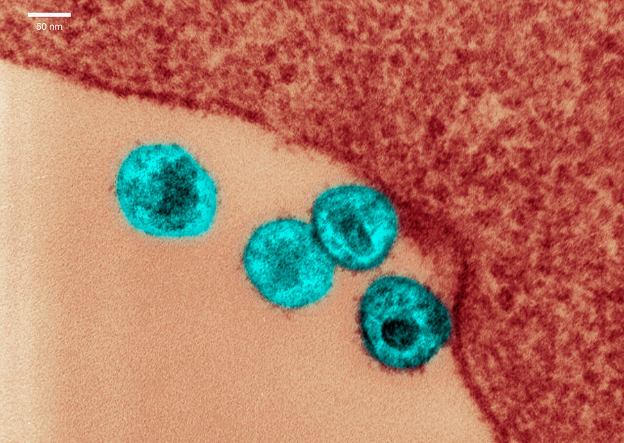 Transmission electron micrograph of HIV #1 Photograph by Callista Images