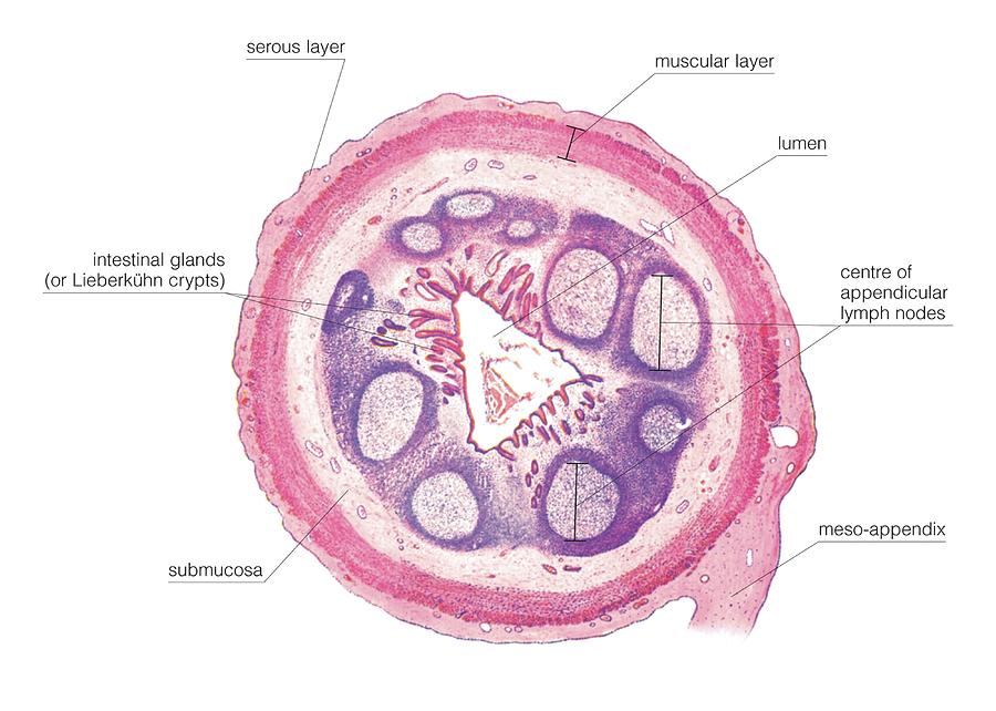 Transverse Section Of Appendix #1 Photograph by Asklepios Medical Atlas
