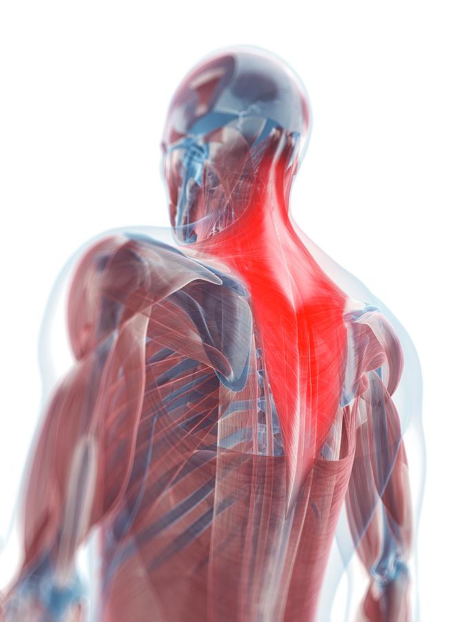 Trapezius Muscle Photograph by Sciepro/science Photo Library - Fine Art ...